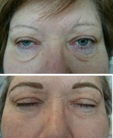 /album/fotogalerie/oboci-4-2-17-jpg/